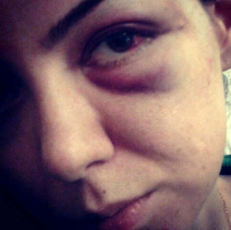 عکس جنجالی کتک خوردن آزاده نامداری