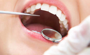 چطور دندان درد را آرام کنیم؟ چطور دندان درد را آرام کنیم؟