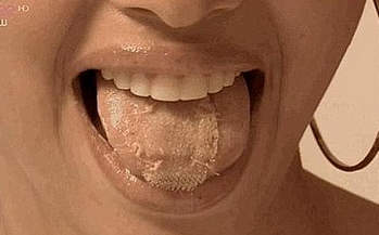 اقدام عجیب و خطرناک دختر ۱۸ ساله برای زیبایی + عکس اقدام عجیب و خطرناک دختر ۱۸ ساله برای زیبایی + عکس