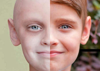 با علائم سرطان آشنا شوید / هیچکس دوست ندارد علائم سرطان