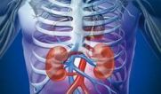 آیا همه انسان ها کلیه های سنگ ساز دارند؟ آیا همه انسان ها کلیه های سنگ ساز دارند؟