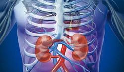 آیا همه انسان ها کلیه های سنگ ساز دارند؟ سنگ کلیه