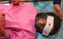 چهارشنبه سوری به سبک عربی ! / مصدومان چهارشنبه سوری ۱۸+ چهارشنبه سوری به سبک عربی ! / مصدومان چهارشنبه سوری 18+