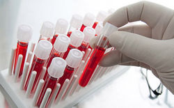 از چه گروه خونی می توانید خون بگیرید یا بدهید؟ + جدول از چه گروه خونی می توانید خون بگیرید یا بدهید؟